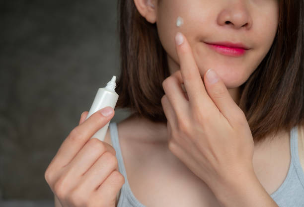 Apa Itu Obat Totol Jerawat? Begini Cara Kerjanya di Kulit