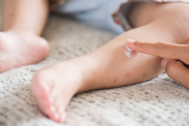 Mau Bayi Terhindar dari Gigitan Nyamuk? Lakukan 6 Hal Ini