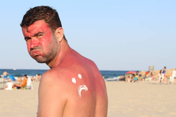 Kulit Sehat Pria Dimulai dari Sunscreen Wajah. Ini Alasannya!