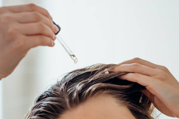 Ini Cara Pemakaian Serum Rambut yang Benar untuk Atasi Masak Rambut