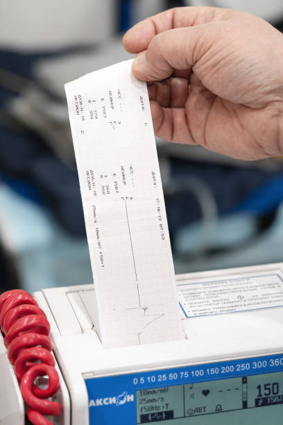 Pakai Printer Thermal Tapi Nggak Tahu Cara Kerjanya? Ini Penjelasannya!