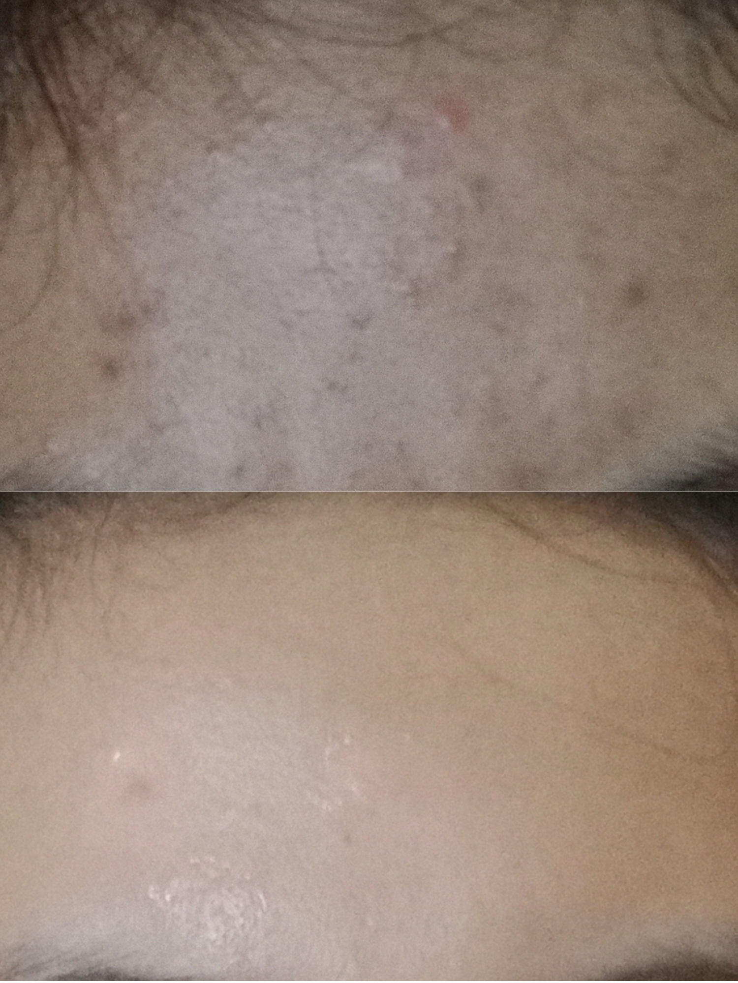 Review The Originote Tranexamid Acid Serum: Efektivitas Produk di Kulit Sensitif