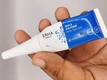 3 Cara Mengatasi Jerawat Hormonal, Dijamin Ampuh!