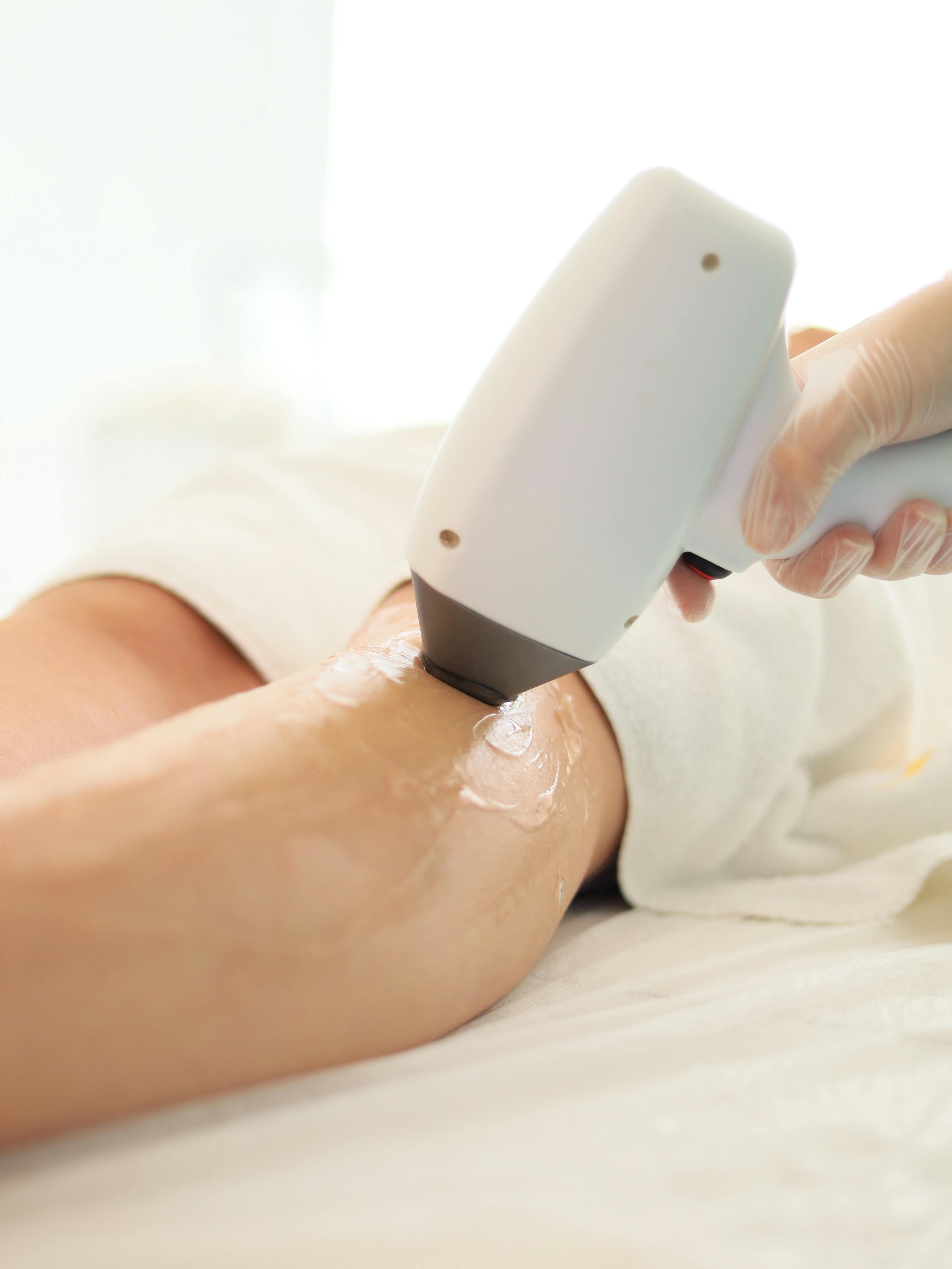 Bukan Sulap Bukan Sihir! Begini Cara IPL Hair Removal Bekerja untuk Kulit Mulus