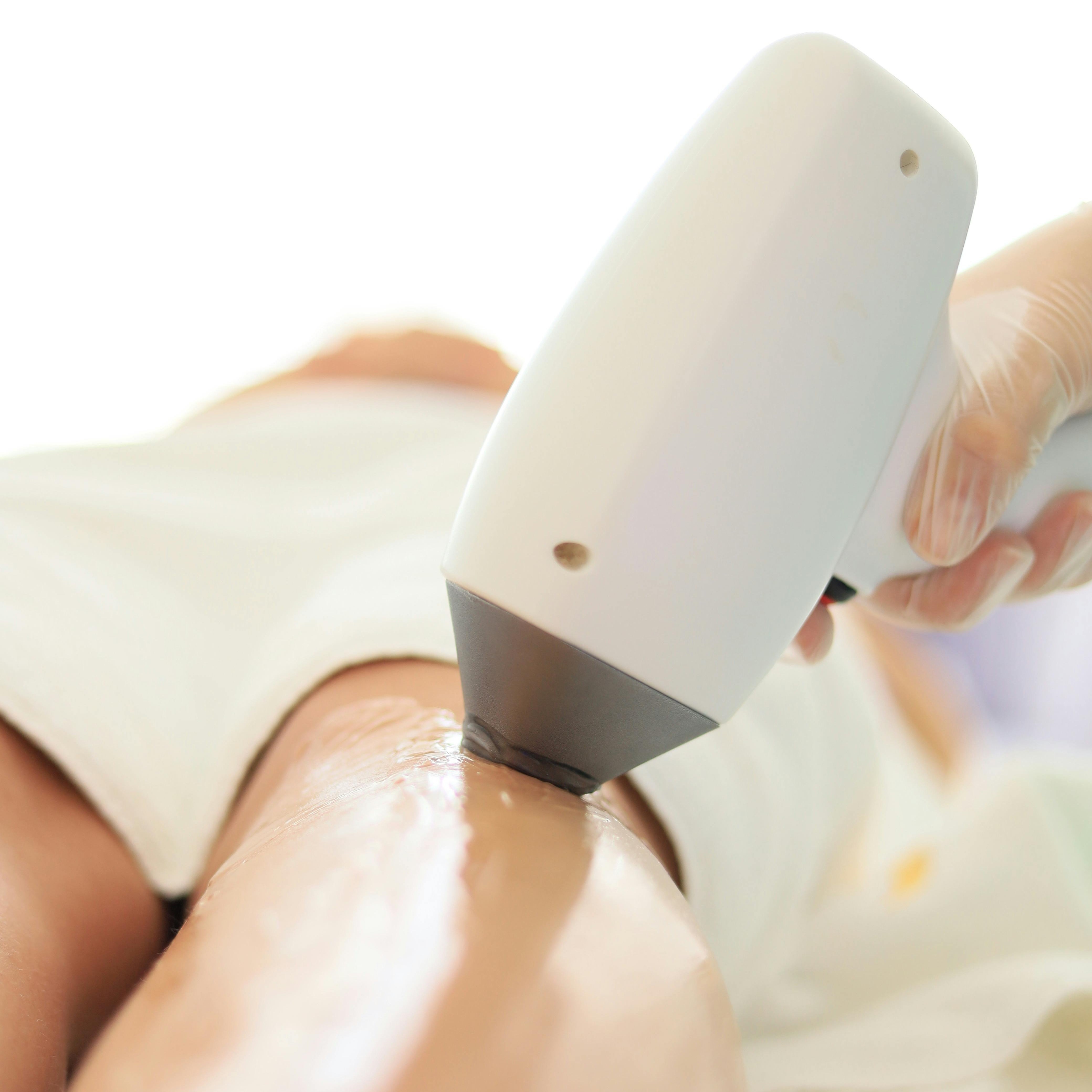 Investasi Sekali, Halus Selamanya! Kenapa Laser Hair Remover Wajib Kamu Punya?