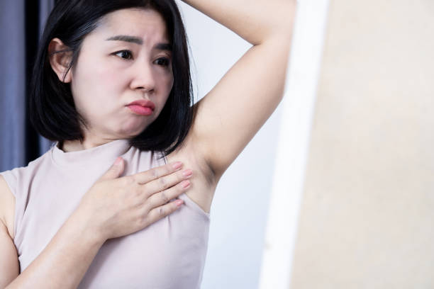 Punya Lipatan Gelap di Badan? Ini Penyebab dan Cara Mengatasinya