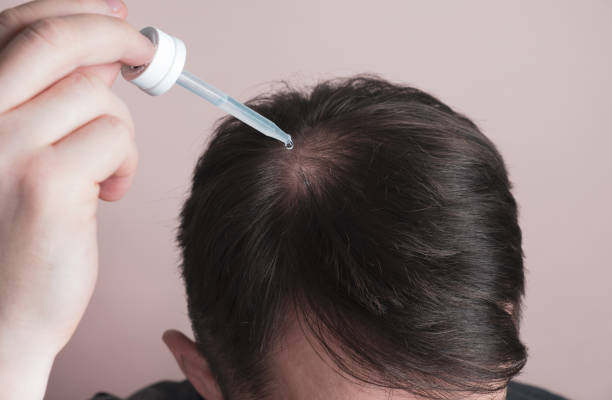 5 Cara Menggunakan Hair Tonic agar Rambut Lebat, Kuat, dan Wangi