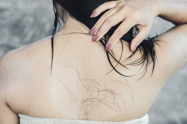 Rambut Rontok karena Styling Berat? Begini Perawatan Harian yang Bisa Kamu Lakukan