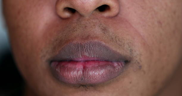 Punya Bibir Gelap? Ini Penyebab dan Cara Merawatnya