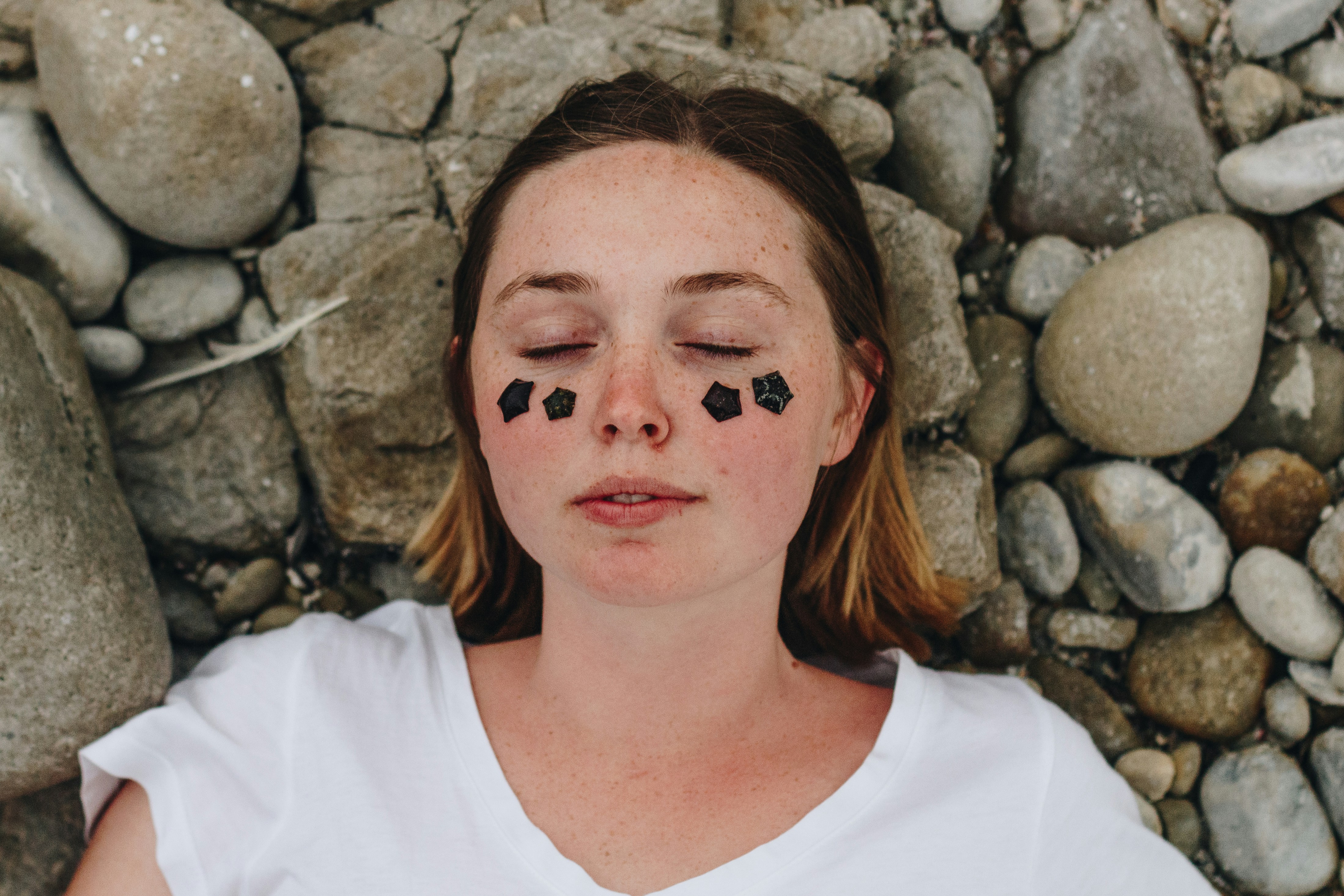 Jerawat Muncul Tiba-Tiba? Acne Patch Solusi Praktis Penyelamat Instan