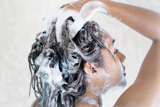 Ini Alasan Shampoo Anti Dandruff Penting Banget, Gak Cuma Bersih