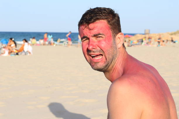 Jangan Anggap Sepele! Ini Akibatnya Kalau Kamu Skip Sunscreen