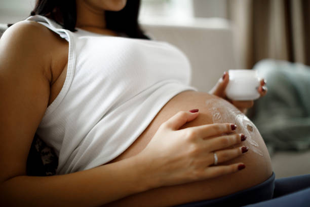 Bumil Wajib Tahu! Ini Cara Samarkan Stretch Marks yang Bisa Dicoba