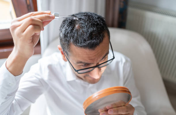 Hair Tonic Bikin Rambut Auto Sehat? Kenalan Dulu Sama Cara Pakai yang Benar