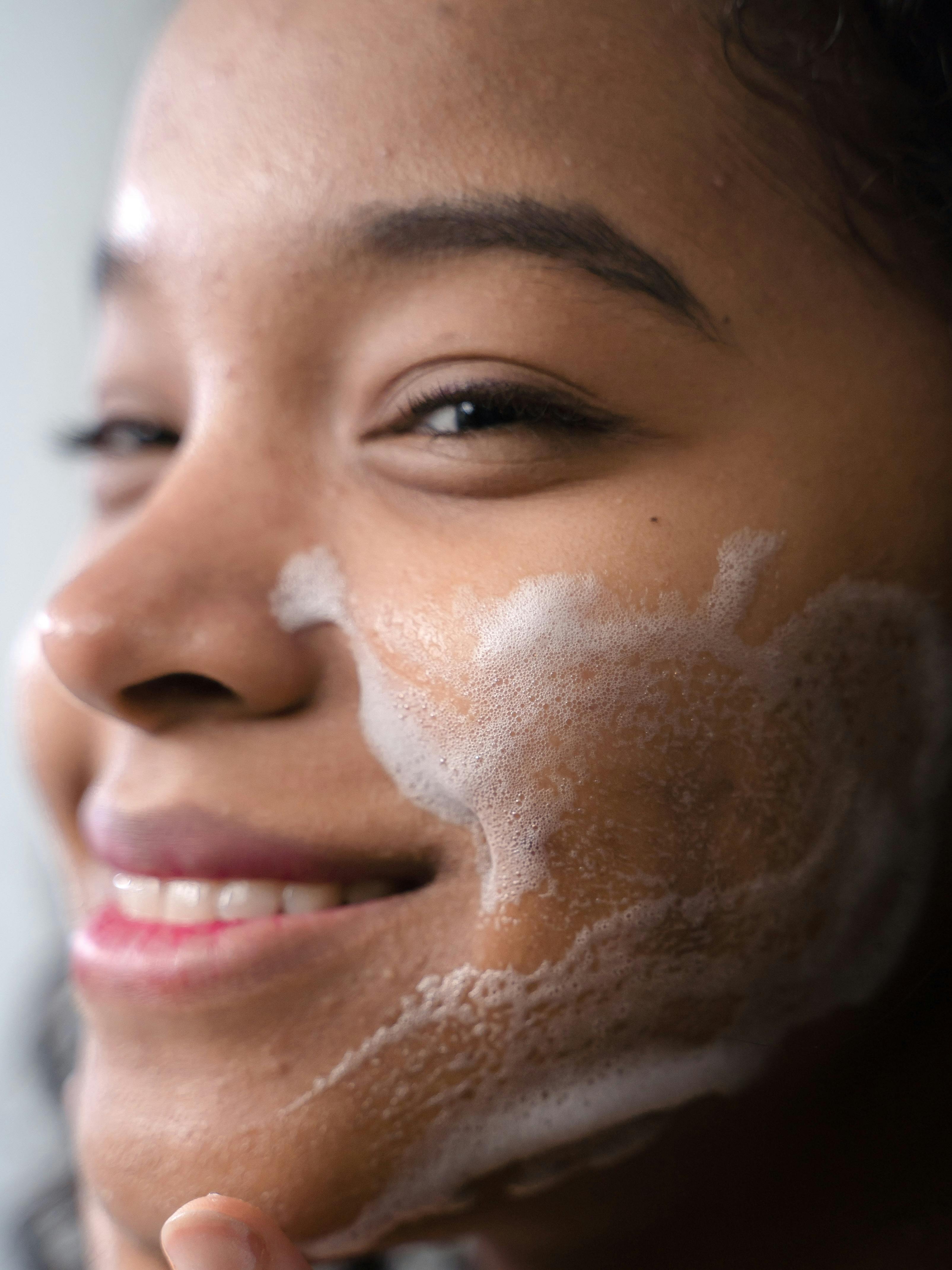 Jangan Salah, Cleansing Oil Justru Cocok untuk Kulit Berjerawat dan Berminyak!