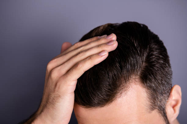 Tips Mengatasi Rambut Lengket dan Risih Setelah Pakai Pomade