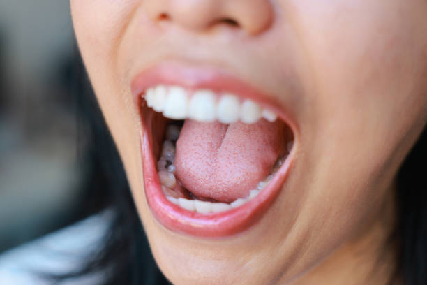 Kenapa Dental Floss Lebih Efektif daripada Sikat Gigi Saja?