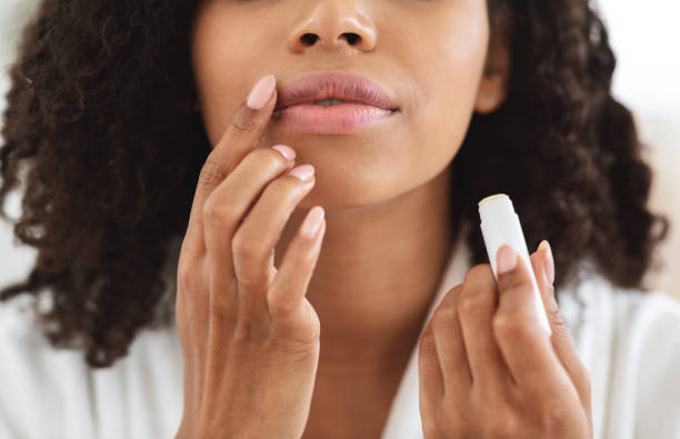 Punya Bibir Gelap? Ini Penyebab dan Cara Merawatnya