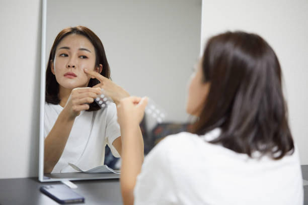 Kapan Waktu yang Tepat Menggunakan Pimple Patch?