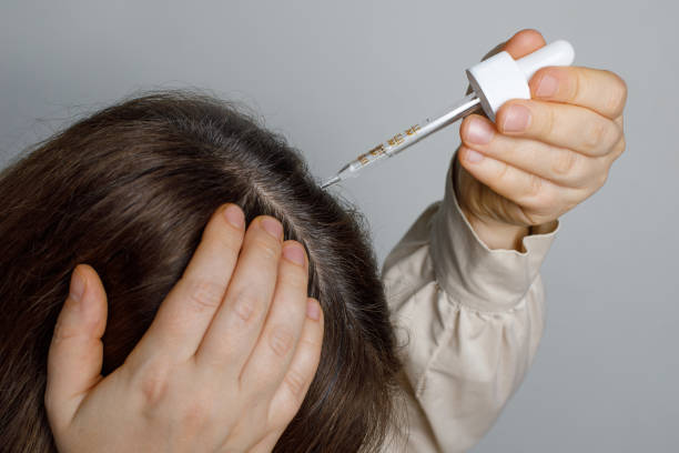 Mending Hair Serum atau Scalp Serum? Kenali Dua Jagoan Perawatan Rambut Ini!