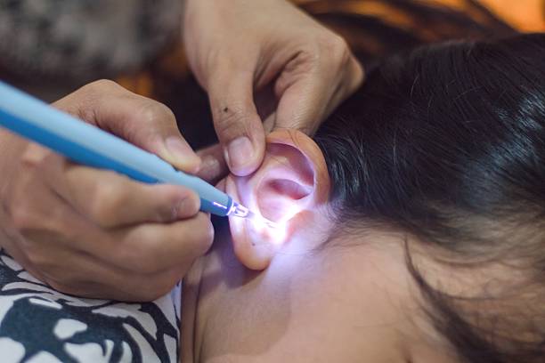 Tips Menggunakan Korek Kuping Kamera dengan Aman dan Praktis