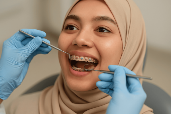 Tren Behel Fashion: Gaya Kekinian yang Diam-Diam Bisa Merusak Gigi Kamu