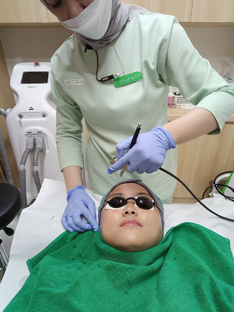 Cuma 20 Menit Me Time, Kulit Langsung Glowing di ZAP Kendangsari (Tanpa Rasa Sakit!)