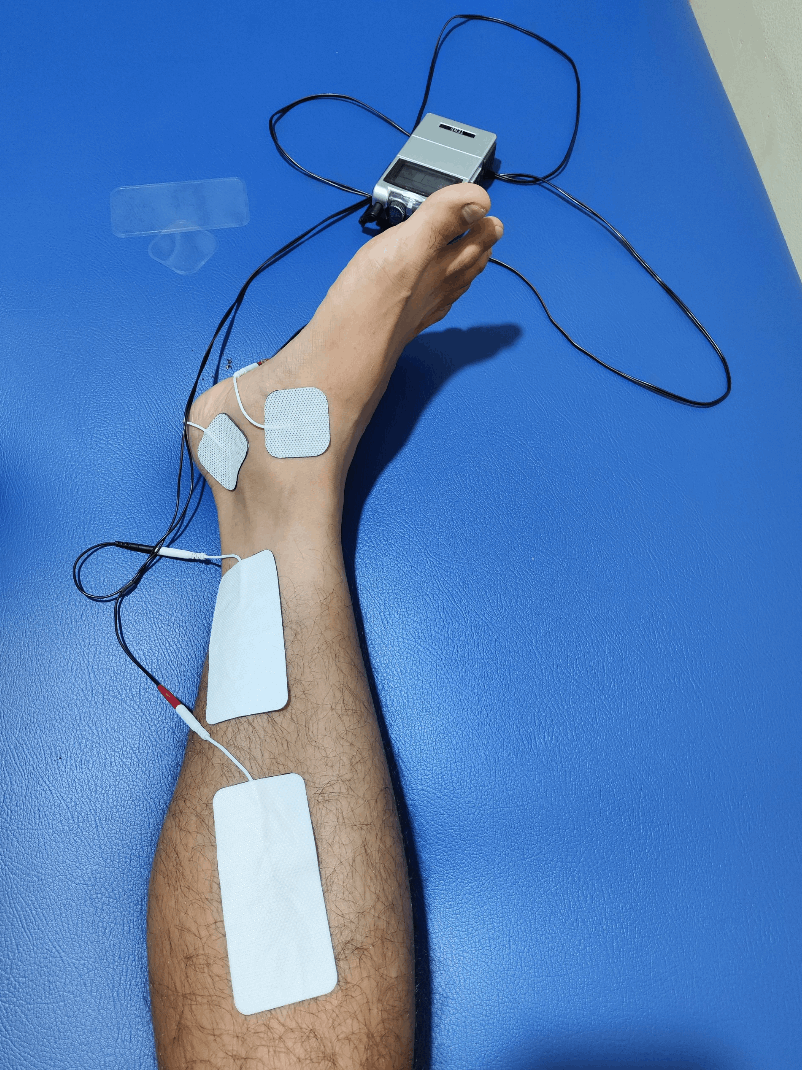 Belajar dari Cidera Tendon: Ambisi Marathon yang Kebablasan