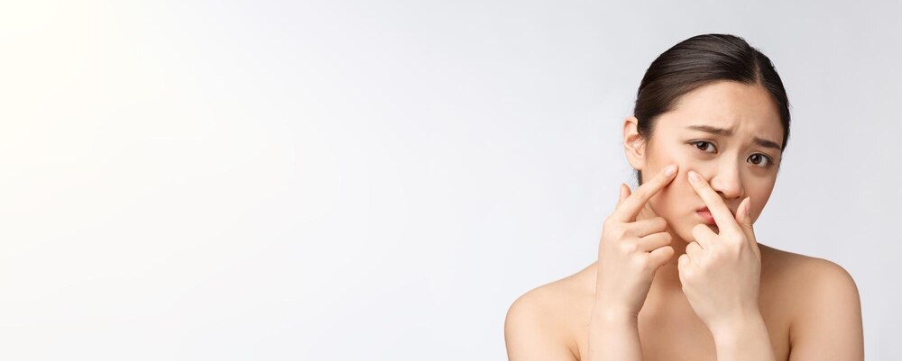 Kulit Berminyak Tapi Pengen Bebas Jerawat? Ikuti 10 Trik Simple Ini!