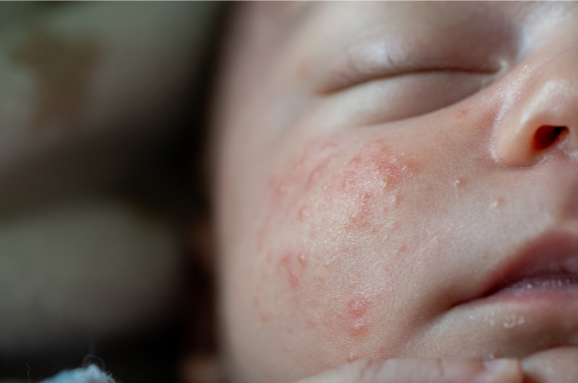 Kulit Bayi Baru Lahir Kok Begitu? Panduan Lengkap Biar Tetap Sehat dan Lembut