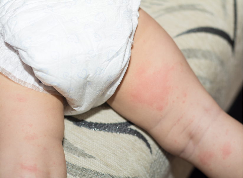 Kulit Bayi Baru Lahir Kok Begitu? Panduan Lengkap Biar Tetap Sehat dan Lembut