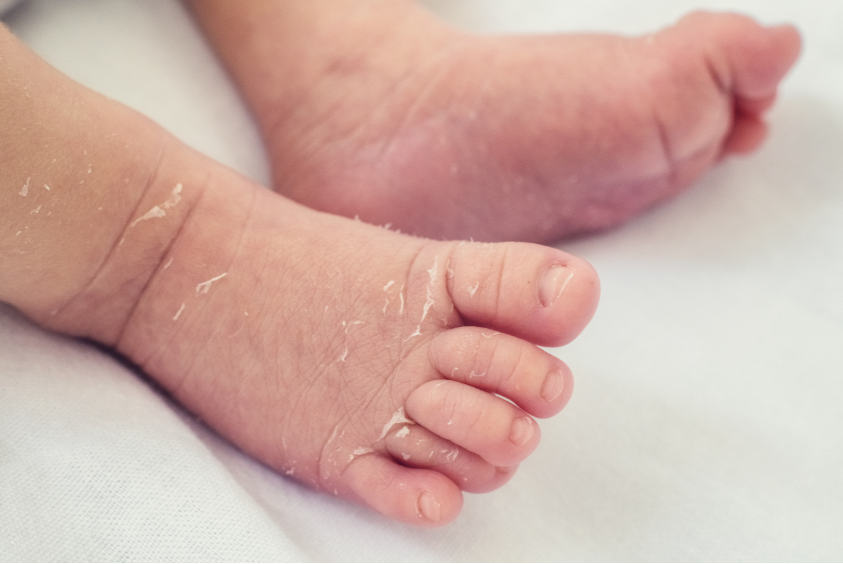 Kulit Bayi Baru Lahir Kok Begitu? Panduan Lengkap Biar Tetap Sehat dan Lembut
