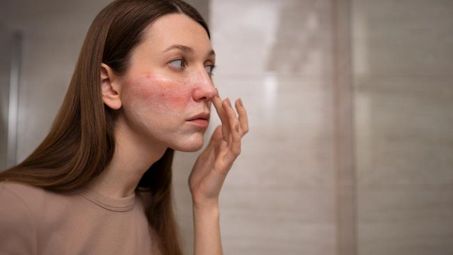 Memperbaiki Skin Barrier dengan Rutinitas Skincare Minimal