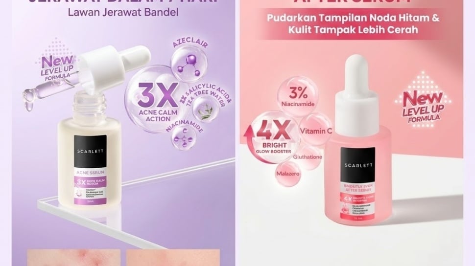 Serum Pemutih vs Serum Flek Hitam: Retinol atau Niacinamide?