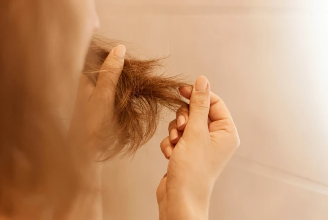 8 Vitamin Rambut Terbaik untuk Rambut Kering dan Rusak