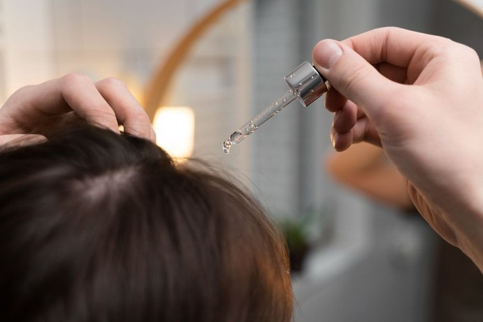 Panduan Dermatologi Mengatasi Ketombe Tanpa Merusak Kelembapan Rambut