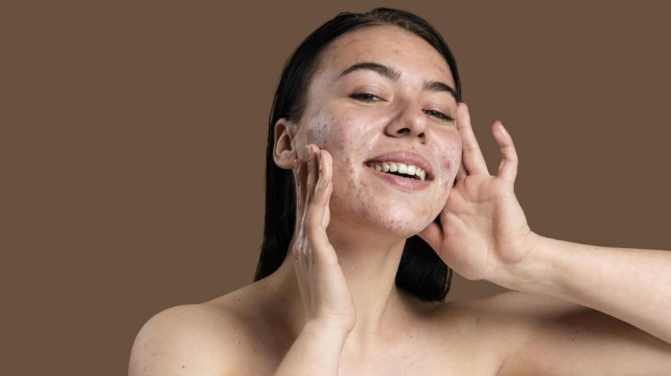 Cleansing Gel Terbaik untuk Kulit Berjerawat dan Berminyak
