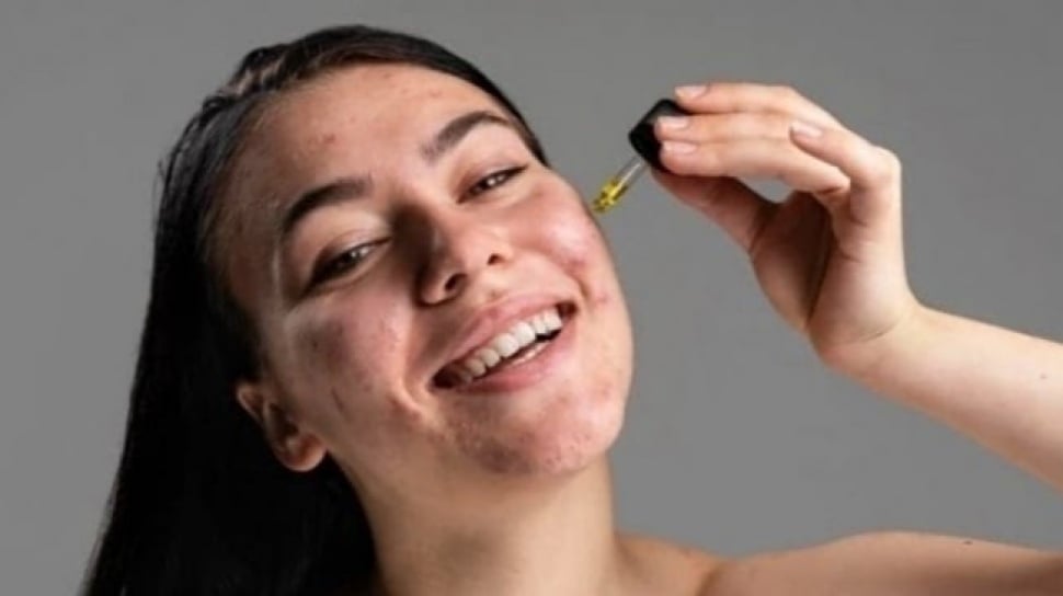 5 Serum Terbaik untuk Kulit Berminyak dan Berjerawat
