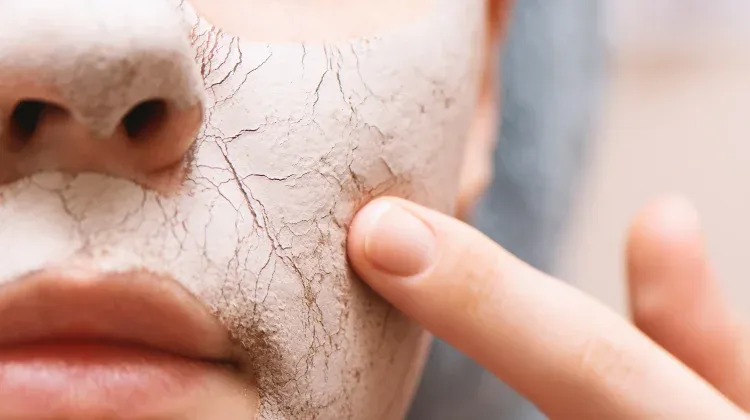 Kulit Kering saat Musim Hujan dan Kemarau: Panduan Hidrasi Alami dan Dermatolog