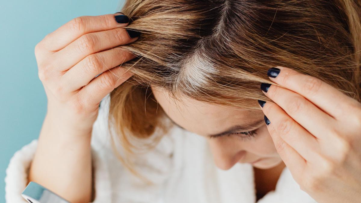 Strategi Dermatologis Mengatasi Ketombe Tanpa Mengorbankan Kelembapan Rambut
