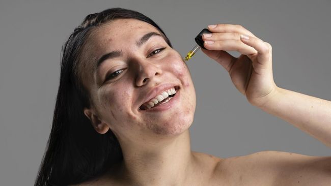 Panduan Lengkap Mengenali Alergi Skincare dan Bahan yang Harus Dihindari