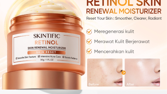 4 Pelembap Retinol Terbaik untuk Bekas Jerawat dan Tekstur Kulit