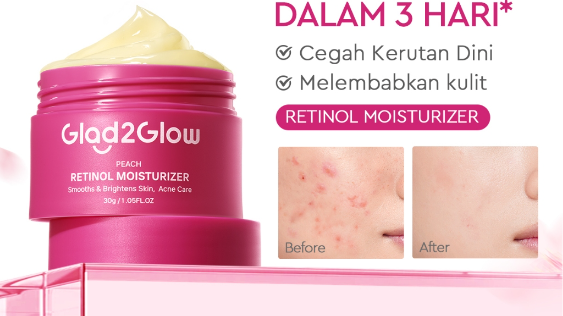 4 Pelembap Retinol Terbaik untuk Bekas Jerawat dan Tekstur Kulit