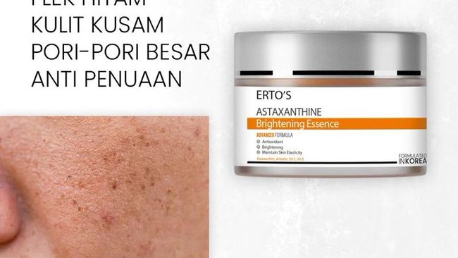5 Produk Skincare Lokal Terbukti Memudarkan Flek Hitam