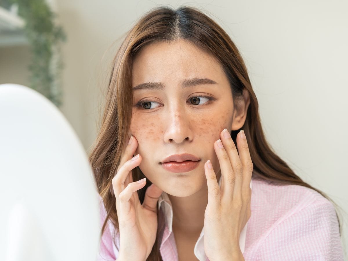 Cara Pakai Sunscreen yang Benar untuk Flek Hitam