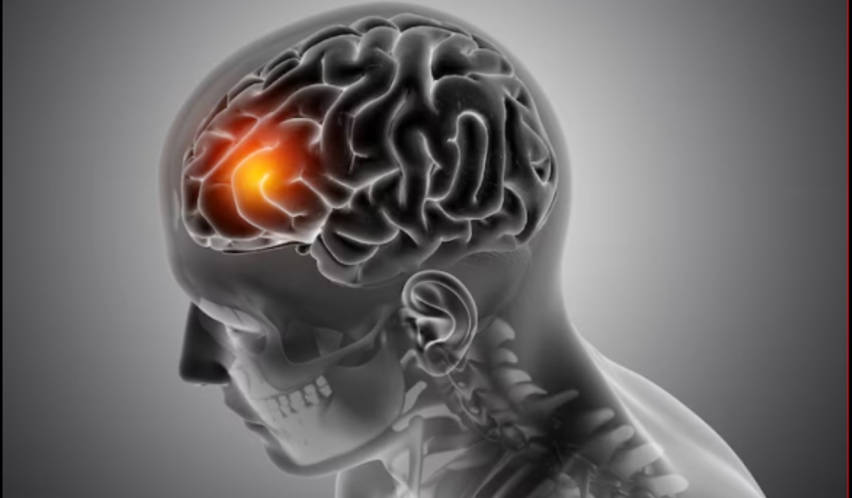Brain Rot Ternyata Pemicu Depresi: Saat Kelelahan Kognitif Berubah Jadi Krisis Mental