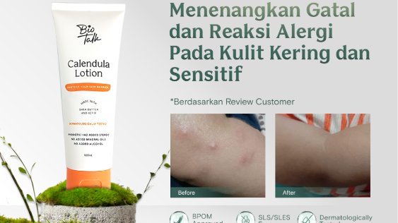 Centella Asiatica dan Ceramide untuk Skin Barrier Kulit Sensitif