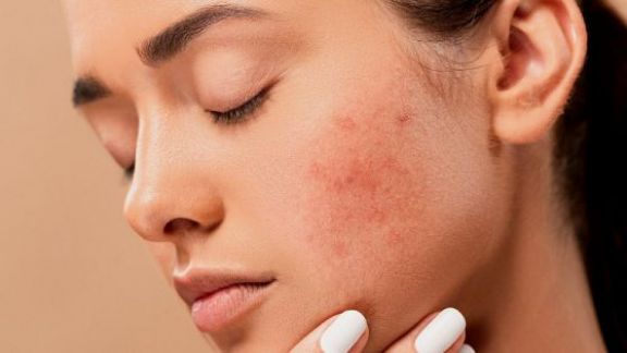 Desain Kemasan Skincare Ringkas dan Higienis Mengubah Cara Kita Merawat Kulit
