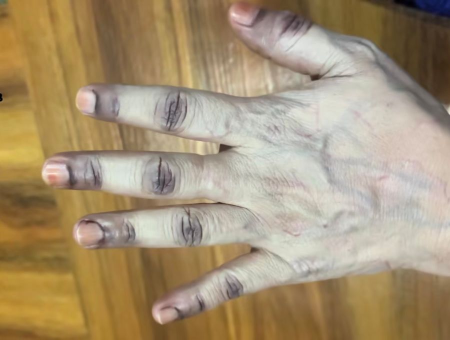 Body Care Viral dan FOMO: Saat Kulit Jadi Korban Tren