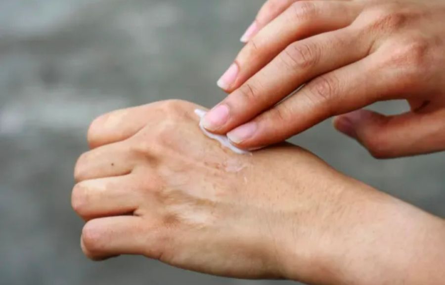 Body Care Viral dan FOMO: Saat Kulit Jadi Korban Tren